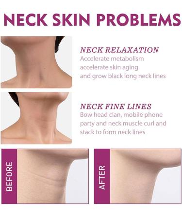 Hydrolyzed Collagen Neck Cream | Anti-Aging & Firming Formula for Beautiful Swan Neck | Reduce Wrinkles & Tighten Skin | Neck Beauty Cream - Buy Online on GoSupps.com