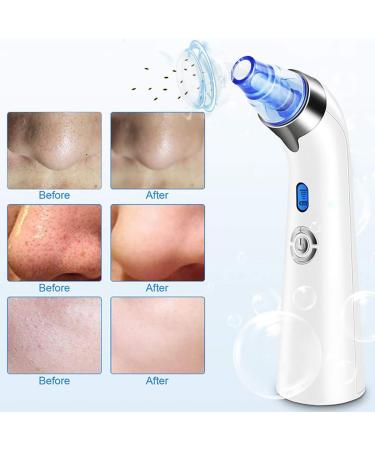 Professional Electric Pore Extractor Tool USB Rechargeable for Girls Women Pore Vacummer - Buy Online on GoSupps.com