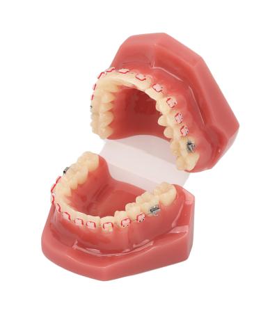 Orthodontic demonstration model for dental research - metal wires and ceramic brackets included - teaching aids for adults