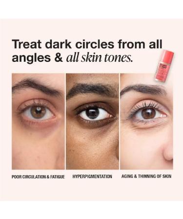 NAPH iNNBEAUTY PROJECT Bright & Tight Dark Circle Firming Eye Cream with Vitamin C & Peptides (0.5 oz / 15 mL) + Bonus Acne Patch (36 Pieces) - Buy Online on GoSupps.com