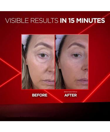 Eye Bag Firming Eraser Instant firming cream against under-eye bags retinol eye lifting serum eye cream against dark circles reduces wrinkles and fine lines (1 - Buy Online on GoSupps.com
