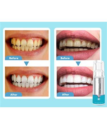 Deep Cleaning Foam Toothpaste - Ultra-Fin Mousse Foam for Effective Teeth Cleaning (1PCS) - Buy Online on GoSupps.com