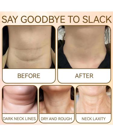 Teegxddy 1 piece firming cream for the neck antiwrinkle cream antiaging cream for neck and d collet for women moisturizes and firms with kolans - Buy Online on GoSupps.com