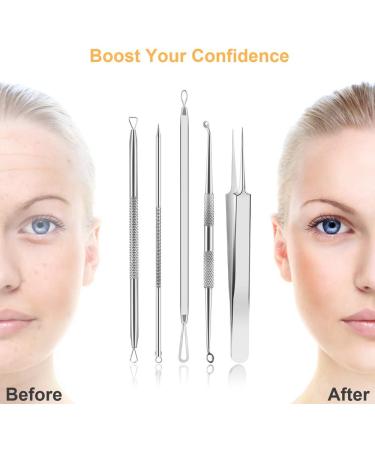 Pimple Popper Tool Kit - UUBAAR 9 PCS Blackhead & Whitehead Remover Tools | Professional Acne Extraction Kit for Facial Nose - Buy Online on GoSupps.com