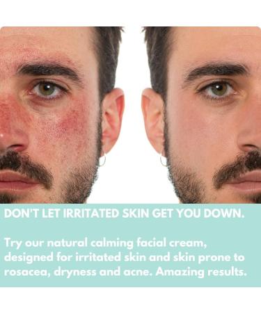 Calming Facial Moisturising Cream. For Rosacea Facial Redness Acne Dry Skin & Eczema 50 ml - Buy Online on GoSupps.com