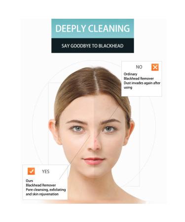 Yuhaever Blackhead Remover Pore Vacuum Kit - Rechargeable, Strong Suction, 4 Probes for Nose & Skin, Face Scrubber - 3 Models - Buy Online on GoSupps.com
