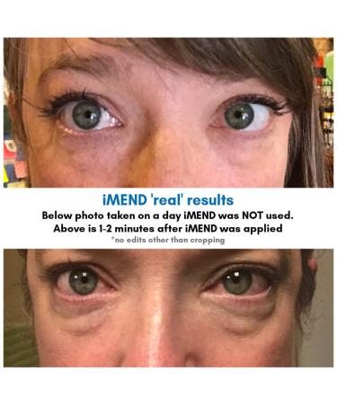 PEAK 10 SKIN iMEND Instant Eye Lift - Tightening Results - 1/2 oz - Buy Online on GoSupps.com