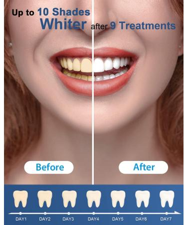 MySmile Teeth Whitening Kit with LED Light - Fast Non-Sensitive Whitener with 3 Carbamide Peroxide Gels - Remove Stains from Coffee, Smoking, Wine & Food - 10 Min Treatment - Buy Online on GoSupps.com