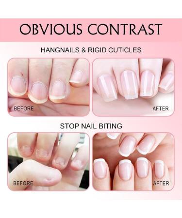  BORN PRETTY Nailive Nail Oil 15ml Cuticle Oil Nail Care Nail Oil Cuticle Cream Cuticle Strengthening Nail Care Kit Cuticle Oil - Buy Online on GoSupps.com
