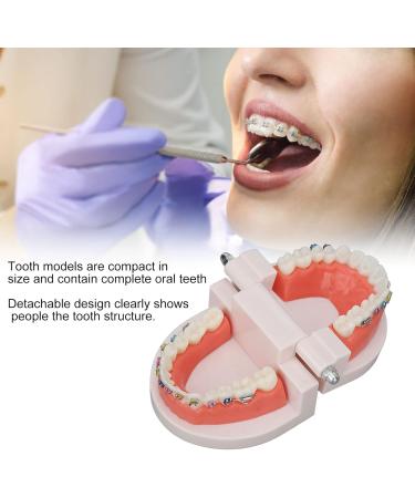 Tooth Demonstration Model - Dental Typodont with Orthodontic Bracket for Dentist Research | International Shipping - Buy Online on GoSupps.com