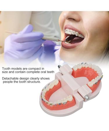 ANGGREK Dental Typodontic Tooth Model with Orthodontic Metal Mount | Ideal for Teaching & Research - International Shipping Available - Buy Online on GoSupps.com