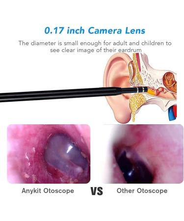 RMENST Ear Wax Removal Kit with HD Endoscope Camera - Earwax Removal Tool for Adults & Kids - Buy Online on GoSupps.com
