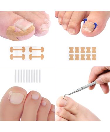 Ilamvie Ingrown Toenail Correction Set - 112 Piece C-Shaped Fill Padding Tool for Easy Ingrown Toenail Treatment - Buy Online on GoSupps.com