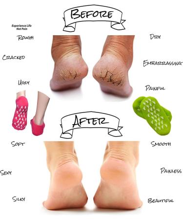 Moisturizing Gel Spa Socks for Dry Cracked Feet - Rose Red & Green, 2 Pair - Buy Online on GoSupps.com