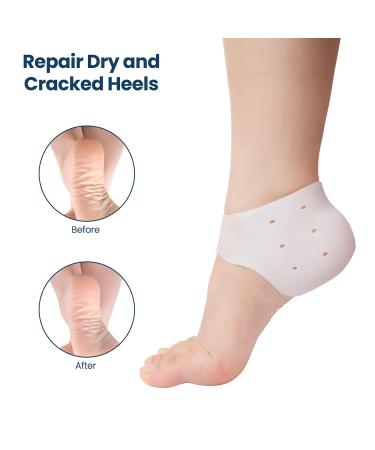 QIQIU 3 Pairs Silicone Heel Protectors | Gel Cups for Plantar Fasciitis & Heel Pain Relief | Heel Sleeves for Dry Cracked Heels | Women & Men - Buy Online on GoSupps.com