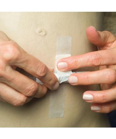 Premium Catheter Holder | Secure Comfortable & International Shipping Available - Buy Online on GoSupps.com