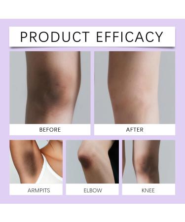 Rubu22a Removes Dark Spots for Body Skin Whitening Cream with Vitamin C for Intimate Zone Skin Lightening Cream Correction for Armpits Knees Elbows Inner Thighs and Bikini Zone 50 50g - Buy Online on GoSupps.com