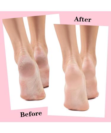 3 Pairs Silicone Moisturizing Socks for Women Silicone Socks for Dry Cracked Feet Women Happy Feet Socks for Women Anti Slip Aloe Moisturizing Socks for Dry Cracked Feet Foot Care for Women - Buy Online on GoSupps.com