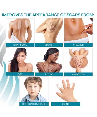 NewGel+ Advanced Silicone Scar Treatment Sheet - 6 Reusable Sheets for Old & New Scars, Surgery, Injury, Keloids, C-Section, Burns, Acne - Clear (4 Count) - Buy Online on GoSupps.com