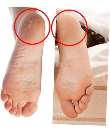 FOMIYES 6 Pairs Foot Softening Socks Elastic Boat Socks Silicone Heel Protectors Plantar Inserts Heel Socks for Cracked Heels Room Socks Shoe Pads for High Heels Spa Jacket - Buy Online on GoSupps.com