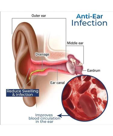 German Cochlear Care Oil for Ear Ringing Relief & Wax Removal Kit - 1pcs - Buy Online on GoSupps.com