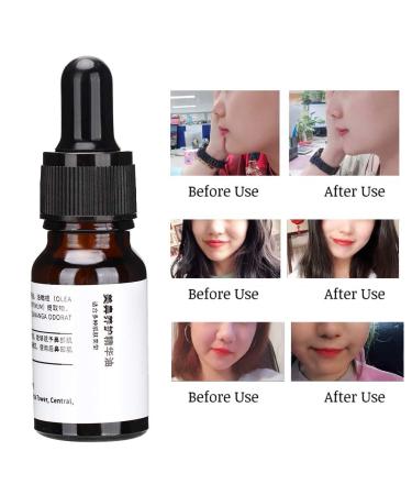 Essential Nose Repair & Reshaping: Magic Nose Up Lifting Shaper for Perfect Contours - Buy Online on GoSupps.com