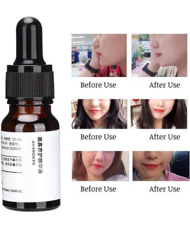ZJchao Nose Up Essence Oil Magic Nose Shaping & Nasal Bone Remodeling for Instant Lift & Contour | International Shipping Available - Buy Online on GoSupps.com