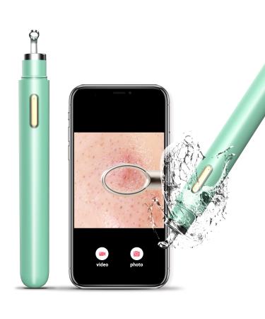 womfenn Visible Blackhead Remover 2022 New   Advanced Pimple Popper with Camera Acne Comedone Whitehead Extractor Kit Skin Care Pore Clean Tool  20X Zoom Aquamarine 01