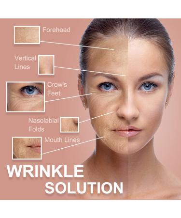 Akissos Forehead Wrinkle Patches - Face Taping for Wrinkles & Double Chin Reduction - Skin Lifting & Smoothing Strips - 2.5cm x 5m - Shop Internationally - Buy Online on GoSupps.com