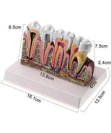PSVOD 4x4 Anatomy Models for Dental Diseases | Educational Tools for Oral Care & Teaching - Buy Online on GoSupps.com