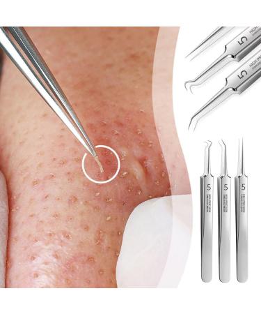 Ultra-fine No. 5 Cell Pimples Blackhead Clip Tweezers Acne Needle Blackhead Remover Kit Blackhead Remover Tweezers Black Dots Pore Cleaner Acne Needle Tool - Buy Online on GoSupps.com