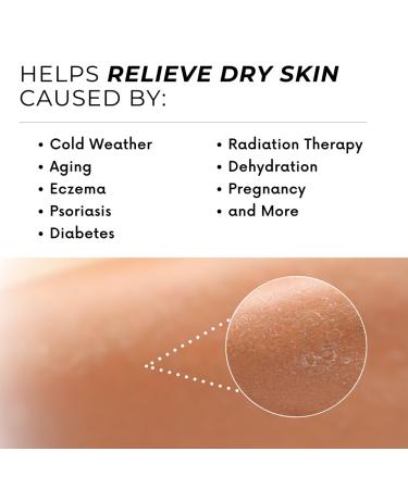 Tropical Ghee Body Butter | Moisturizer for Extreme Dry Skin | Shea Butter for Sunburn & Eczema | Mango Avocado & Coconut Oil | Pharmacist Formulated - Buy Online on GoSupps.com