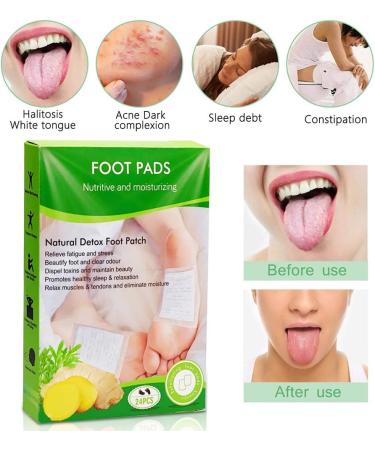 Xnuoyo Natural Detox Foot Patches Promote Blood Circulation Relieve Pain & Improve Sleep 24PCs Wormwood Foot Pavement for Moisture & Cold Relief - Buy Online on GoSupps.com