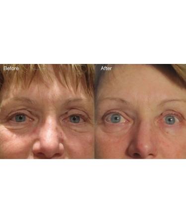 Buy DNA Code Swiss Apple Stem Cell Complex Serum - Anti-Aging Argireline Matrixyl 3000 Hyaluronic Acid & CoQ10 - 2 OZ | International Shipping Available - Buy Online on GoSupps.com