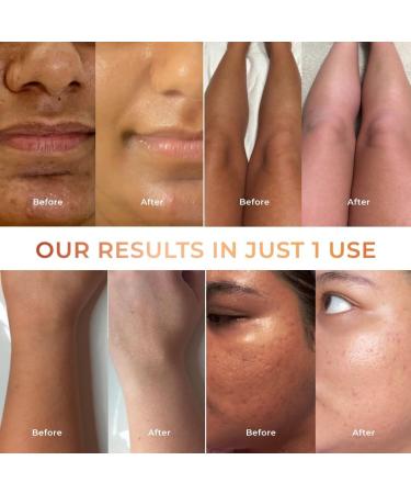 Ni.coni Tan Vanish Gluta-Kojic Skin Polish pH Balanced Tan Reducing Formula 180g/6.08fl.oz - Buy Online on GoSupps.com