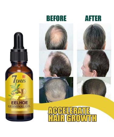 1/2/3pcs Hair Growth Serum Hair Growth Serum Natural Hair Growth Essence Contains Ginseng Promotes Natural Hair Growth (3pcs) - Buy Online on GoSupps.com