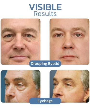 VEMART Awaken Peptide Depuffing Eye Gel for Men - Lifts, Firms, and Reduces Dark Circles - 3pcs - Buy Online on GoSupps.com
