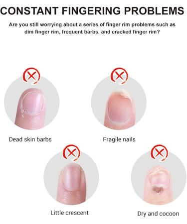 Huile de cuticule Nail Cuticle Oil 10ML*2 Hydrater Apaiser R g n rer Nourrir et Favoriser la Croissance Saine des Ongles ENAILOIL-011 - Buy Online on GoSupps.com