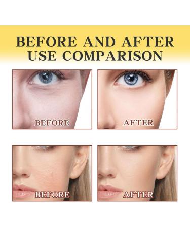 2Pcs Royal Jelly Face Cream Bee Venom Lifting Face Cream Anti Aging Face Cream for Dry Face - Buy Online on GoSupps.com