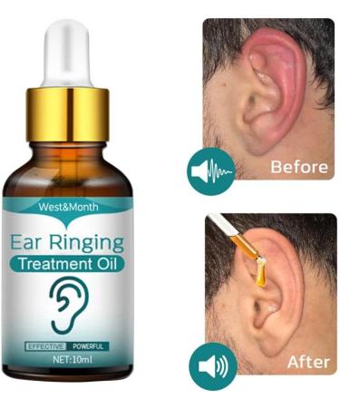 Non-Pungent Tinnitus Ear Drops - Lightweight Functional Relief Oil with Herbs - Style A Color 10ML - Buy Online on GoSupps.com