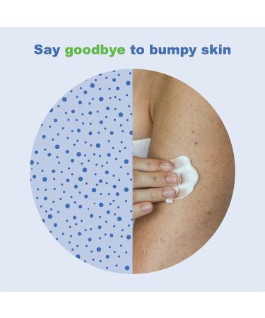 KP Elements Keratosis Pilaris Lotion (4 fl oz) - Natural Treatment for KP | Vegan & Exfoliating AHA Moisturizer | Made in USA | 4 fl oz - Buy Online on GoSupps.com