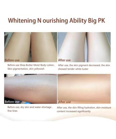 Enhancing Shea Butter Deep Conditioning Moisturizing Hand and Body Lotion 250g Body lotion Cream Shea Butter Moisturizing Body Lotion Nourishing Body Care Cream for All Skin Types - Buy Online on GoSupps.com
