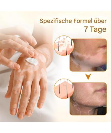 Cr me pour les pieds - Cr me de soin pour les pieds - Nourrissante et claircissante aux extraits de - Soin hydratant pour peaux s ches et sensibles - Corps et mains - Buy Online on GoSupps.com
