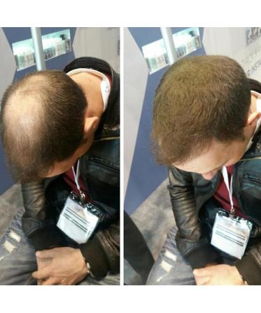 Topaxx Hair Building Fibers - Natural Hair Thickener for Men & Women - Black 0.97oz - Buy Online on GoSupps.com