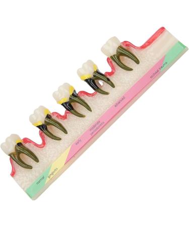 Shop Verdant Touch Tooth Model - Dental Periodontal Disease Study Tool for Schools | International Shipping Available - Buy Online on GoSupps.com