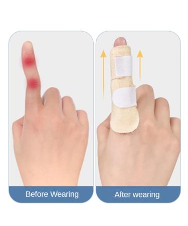 YiYLunneo Adjustable Finger Strap - Corrector for Sprains Dislocations & Fractures | International Shipping Available - Buy Online on GoSupps.com