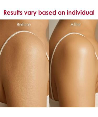  DzpKrka Firming Body Cream | 118ml Moisturizing Cream | Nourishing Lotion Morning and Evening After Cleansing | Under Makeup - Buy Online on GoSupps.com