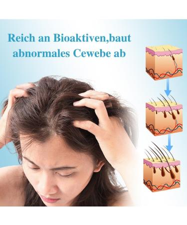 Cr me hydratante naturelle cuir chevelu Exfoliant Cuir Chevelu Hydratant et nourrissant convient au corps et les cheveux (100g) - Buy Online on GoSupps.com