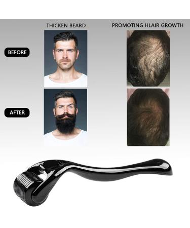 Xyemao 3-in-1 Titanium Derma Roller Set for Beard, Hair, Skin, and Face - Self Care Gifts for Men and Women - 540 Microneedles (0.5mm, 1.0mm, 1.5mm) - Black - Buy Online on GoSupps.com