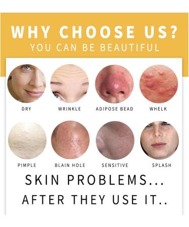  GYORI 2 x Waterfalls Turmeric Brightening Soap Waterfalls Turmeric Soap Kojic Acid and Turmeric Soap Bar for Dark Spots Smooth Skin for on Face and Body - Buy Online on GoSupps.com